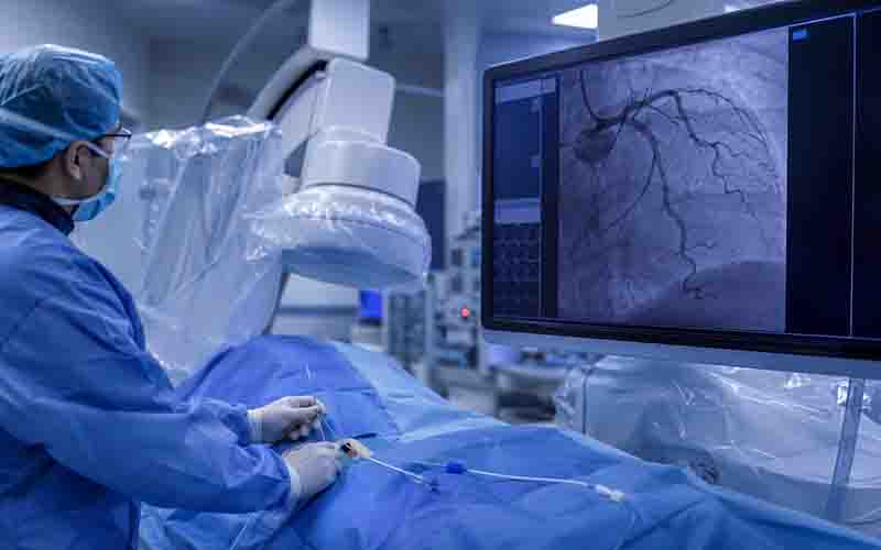 Coronary Angiography